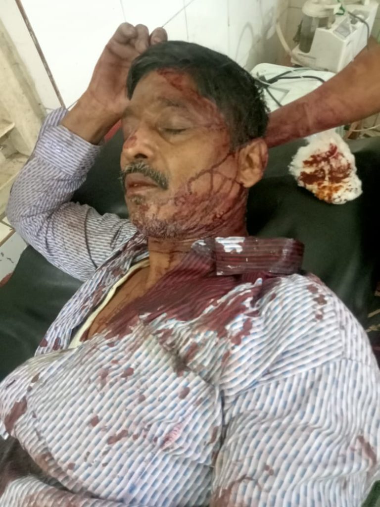 আনোয়ারায় জমি নিয়ে সংঘর্ষ, ৭২ বছরের বৃদ্ধাসহ আহত ৩
