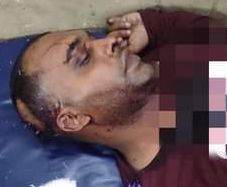 ফটিকছড়িতে এক শিক্ষককে মেরে রক্তাক্ত করেছে ছাত্ররা