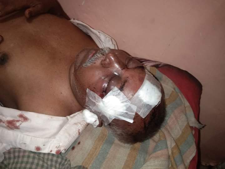 মিরসরাই ১২ নং খৈয়াছড়া ইউপির সাবেক চেয়ারম্যান জাহেদ ইকবালকে কুপিয়ে জখম