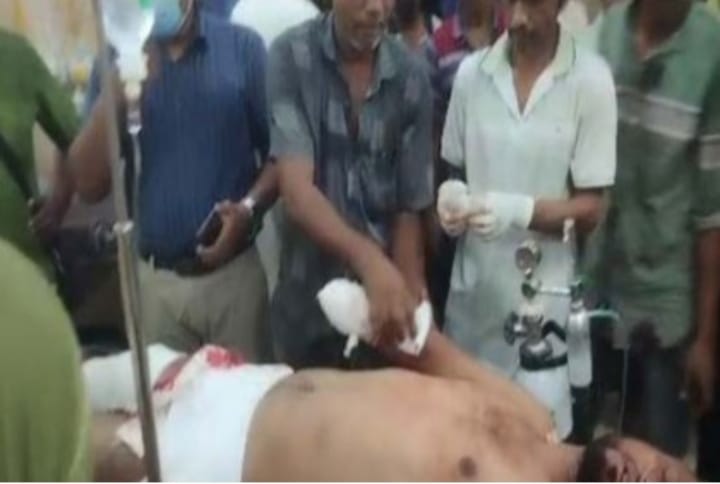 “নাটোরে প্রতিপক্ষের হামলায় যুবলীগ নেতার হাতের কবজি বিচ্ছিন্ন “