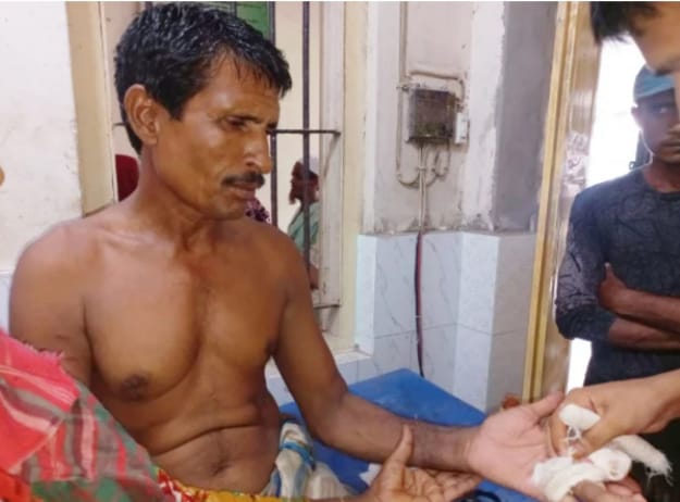 ” নাটোরের লালপুরে শিয়ালের কামড়ে তিন গ্রামের সাতজন আহত”