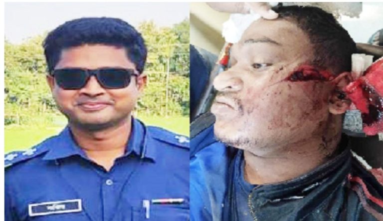 কালীগঞ্জে ৫ পুলিশকে কুপিয়ে আহত গ্রেফতার ২