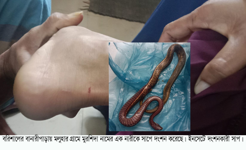 সাপে কাটা রোগী সাপ নিয়ে হাসপাতালে !