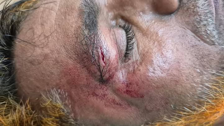 রাঙামাটিতে সাংবাদিক কামালের ওপর যুবলীগ নেতার হামলা, আহত অবস্থায় হাসপাতালে ভর্তি