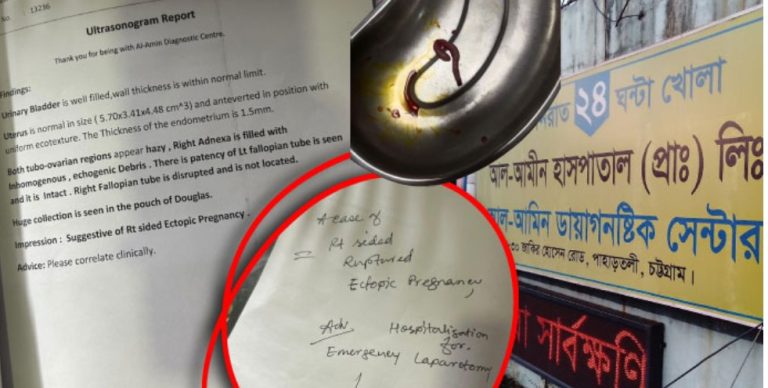 চট্টগ্রামে গৃহবধূর পেট কেটে অপারেশন, ডাক্তার জানালেন ‘বাচ্চাই ছিল না’