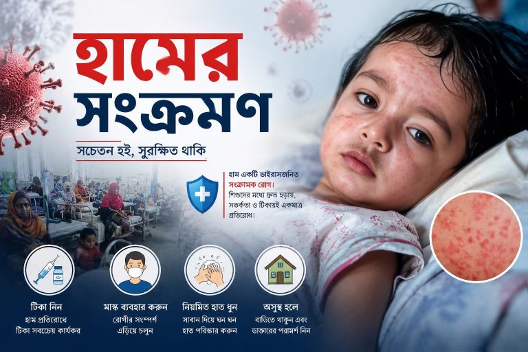 বরিশালে বাড়ছে হামের প্রকোপ, বিভাগীয় হাসপাতালে রোগীর চাপ চরমে