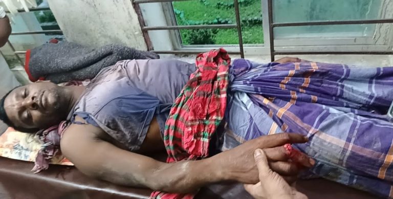 বকশীগঞ্জে বজ্রপাতে বাবা-ছেলে গুরুতর আহত