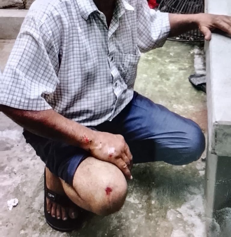 ভাঙ্গায় রেকর্ড সংশোধনী মামলা করায় ক্ষোভ: চাচাকে পিটিয়ে জখম করল ভাতিজা 
